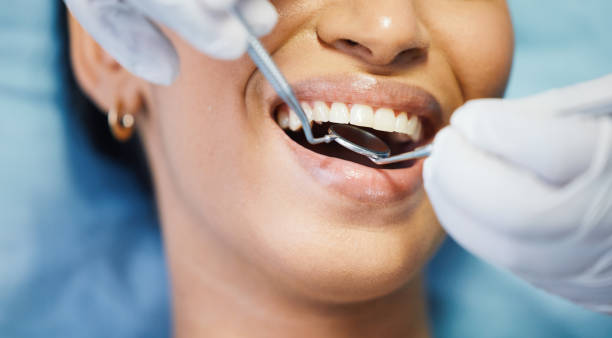 Best Emergency Root Canal Treatment in Bowie, MD